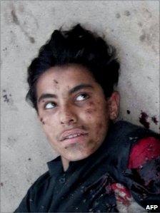 This picture taken on April 3, 2011 shows the injured suicide bomber with his explosive vest partially detonated lying on the ground