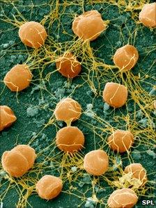 SEM of Pyrococcus furiosus archaea