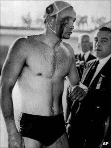 Blood streams from the cut eye of Hungarian Ervin Zador injured during a fight with a Russian in the closing stages of the Hungary vs. Russia water polo match in Melbourne, Australia December 6, 1965