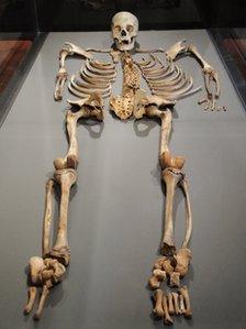 Skeleton of a young man part of the Yale exhibit at Casa Concha