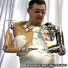 Man with bionic arms