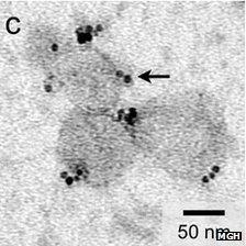 Microvesicles