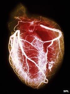 Heart and arteries