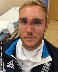 Stuart Broad