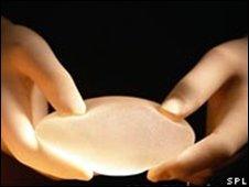 Breast implant