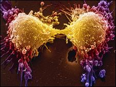 Cancer cell dividing, SPL