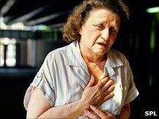 A woman having a heart attack