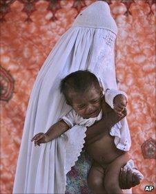 Mother holds a child with skin disease in Kot Addu village