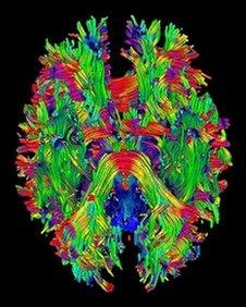 Brain scan