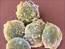 Blood cancer cells