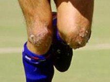 The knees of former Oldham player Frank Bunn during a match on the plastic pitch at Boundary Park