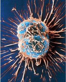 Cervical cancer cells dividing