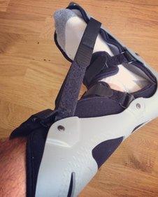 Example's leg brace