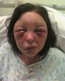 Domestic abuse victim