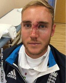 Stuart Broad