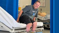 What Drives People to Choose Amputation of Healthy Limbs?