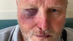 I was punched in the face for driving at 20mph