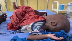 Abdiwali Abdi at Dollow district hospital the day before he died