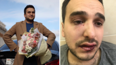 Colagem de fotos de Maksim Khoroshyn; a primeira, sorrindo segurando um buquê; a segunda, com o rosto ferido