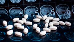 NHS will not fund new drug to slow Alzheimer’s