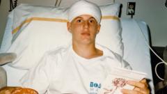 Jeff in Huntington Hospital, five days after brain surgery (August 1986)