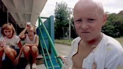 Anak-anak Chernobyl