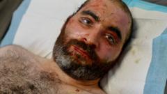 We're not military - why are we being hit, asks injured man in Lebanon