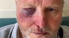 'Ges i fy nyrnu yn fy wyneb am yrru 20mya'