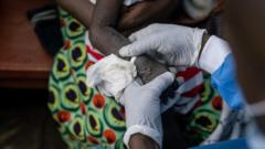 Epidémie de mpox en RDC : la course aux vaccins est lancée dans le pays