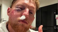 Stokes injured after being hit in face by ball