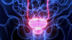 Men being over-treated for prostate cancer, says charity