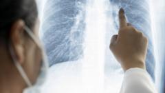 akciğer röntgeni
