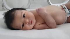 Fotografia colorida mostra um bebê muito pequeno de cabelo preto deitado em uma encubadeira olhando para a câmera