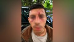 Jewish man 'kicked like animal' in Golders Green attack