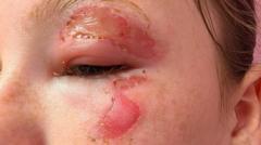 'Serious burn' warning after children heat squishy toys in microwaves