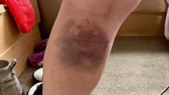 Plea to dog owners after delivery driver attacked