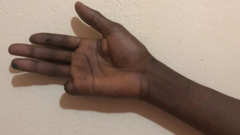 Mahamat Nour Mamadou yabwiye HRW ko Abarusiya bamuciye urutoke bakoresheje imbugita