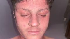 Skin cream withdrawal pain 'like being electrocuted' left footballer stuck in bed