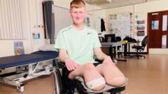 Teen footballer who lost legs happy to be alive