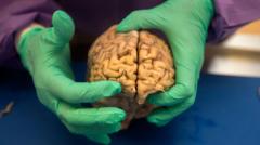 Brain disease in ex-NFL players 'higher than previously shown'