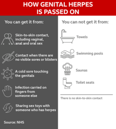 A graphic with information from NHS on how genital herpes is passed on (sex, contact, cold sore touching genitals, infection on fingers, sharing sex toys) and how it is not passed on (towels, swimming pools, saunas, toilet seats)