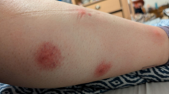 Villagers 'tormented' by return of mosquitoes