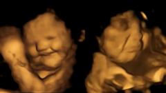 The baby on the left appears to be smiling while the baby on the right appears to be grimacing