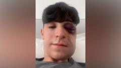 Man's jaw broken in random attack after late shift