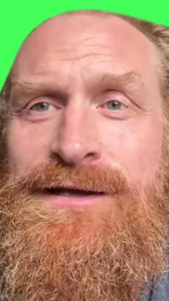 Norway are underdogs but anything can happen - Game of Thrones star 