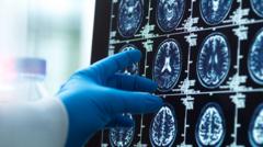 AI used to help diagnose dementia in UK first