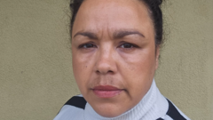 I need 120 pills a week to deal with the agony caused by vaginal mesh