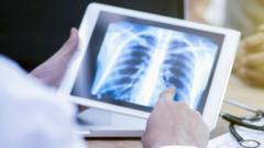 Harrow records highest rate of TB in London