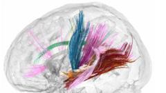 Pregnancy brain changes revealed in detailed scans