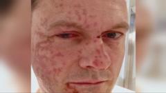 Tory leader relives acid attack as he hits out at parole system